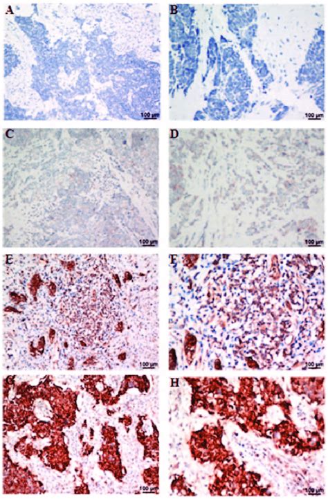 Immunohistochemical Analyses Of Chromogranin A Cga Staining In Small