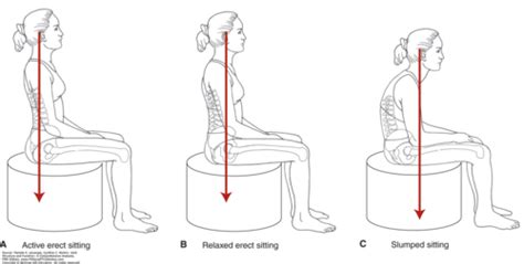 Functional Anatomy Posture Flashcards Quizlet