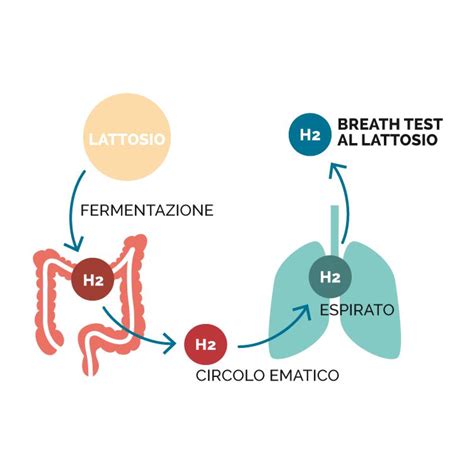 Breath Test Lattosio Laboratorio Materano