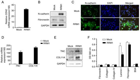 RRM1 Is Mediated By Histone Acetylation Through Gemcitabine Resistance