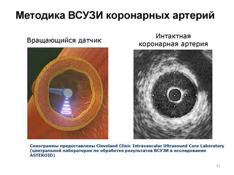 Синдром коронарной недостаточности - презентация онлайн