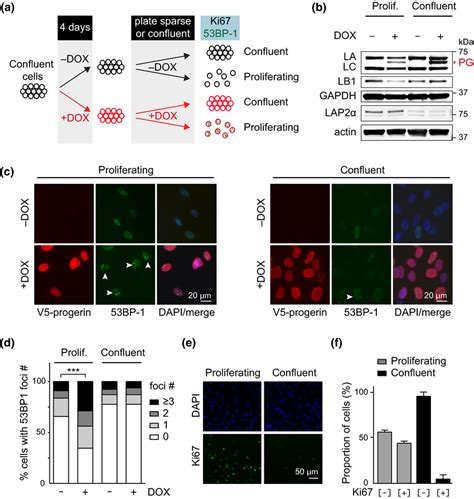 Progerininduced Dna Damage Is Restricted To Proliferating Cells A