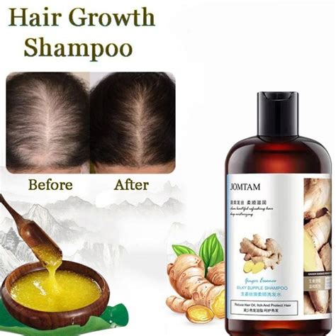 Hair Grower Shampoo Ginger Growth Serum Rapid Grower Treatment Anti