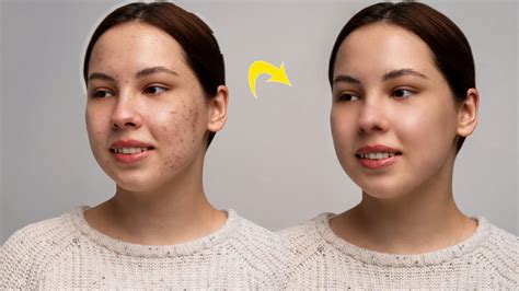 Face Retouching Best Photoshop Tutorial Skin Retouching 2023 Youtube