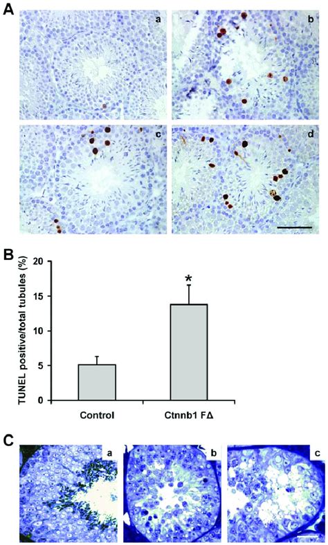 Increased Germ Cell Apoptosis In Ctnnb1 Fd Mice Testes A Tunel