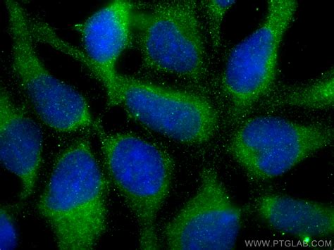 Collagen Type II Antibody 28459 1 AP Proteintech