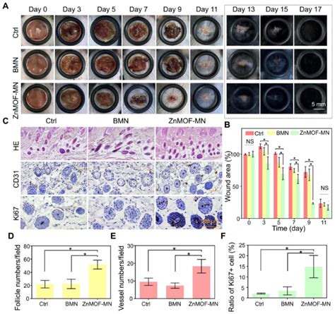 In Vivo Hair Growth Evaluation And Histological Study In C57BL 6 Mice