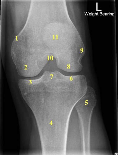 Imaging Mod 7 Pt 1 Knee Flashcards Quizlet