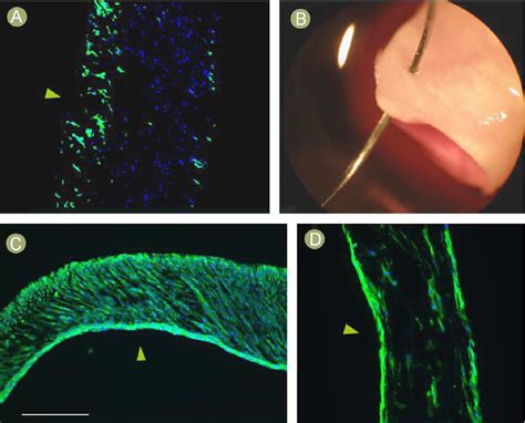 Figure 2 From Development Of A Tissue Engineered Vascular Graft