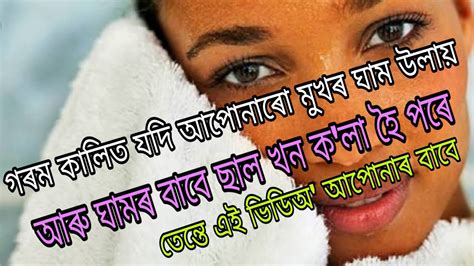 গৰম কলত যদ আপনৰ মখৰ ঘম উলয আৰ ঘমৰ বব ছল খন ক ল হ পৰ