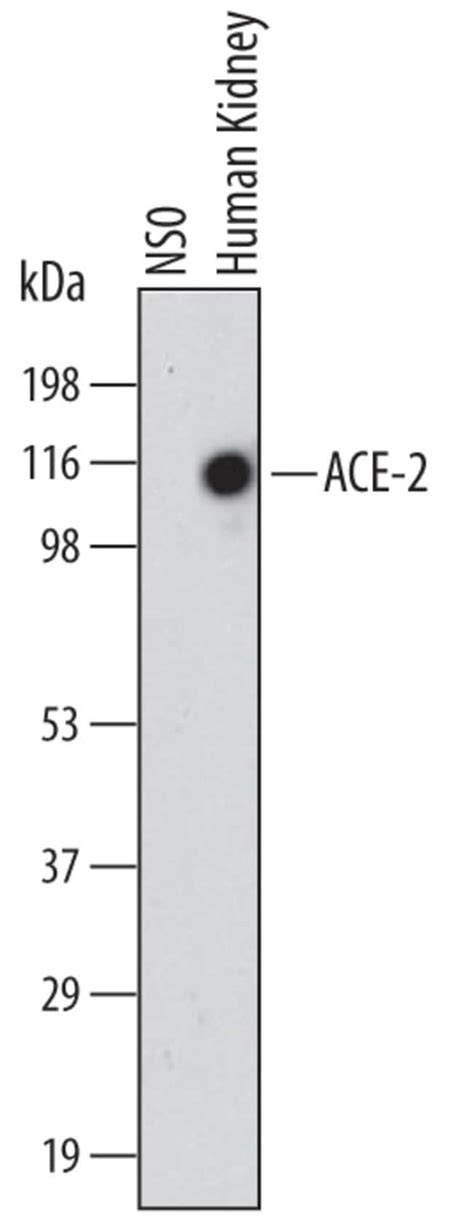 Human Rat Hamster ACE 2 Antibody R D Systems 25μg Unlabeled Fisher