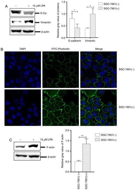 Lysophosphatidic Acid Induces The Migration And Invasion Of Sgc