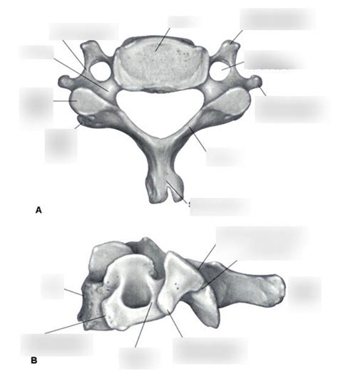 Cervical Vertebrae Diagram Quizlet