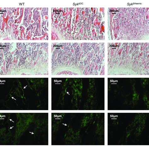 Histological And Immunofluorescence Analysis Of Osteoclast Specific