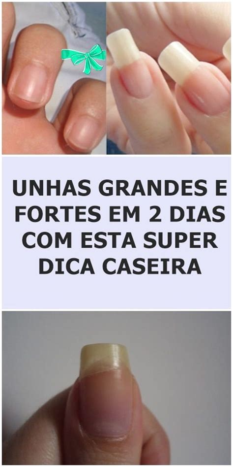 Unhas Grandes Em 2 Dias Receita Feita Em 5 Minutos B0E Em 2024