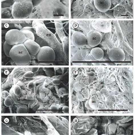 Scanning Electron Micrographs Sem Of Semi Engorged Females Salivary