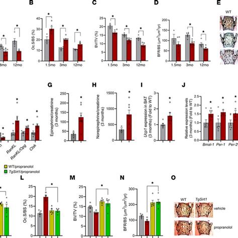 Increased Sympathetic Tone And Decreased Bone Mass In TgSirt1 Mice A