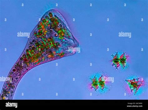 Polarised Light Micrograph Of A Stentor Sp Protozoan Left And