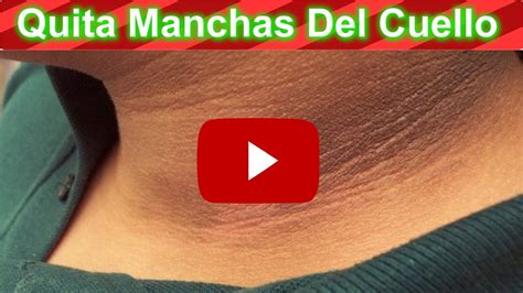 Mira Esta Pasta Para Quitar Las Manchas Del Cuello Rapidamente YouTube