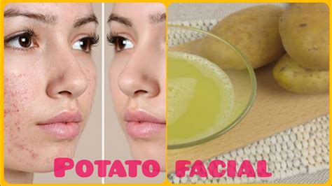 Skin Whitening Potato Facial Bleach Get Fair Spotless Glowing Skin