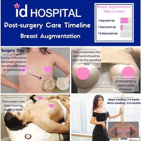 Recovery Process For Breast Augmentation Surgery Idhospital