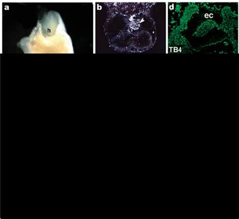 Thymosin b 4 is expressed in specific cardiac cell types during ...