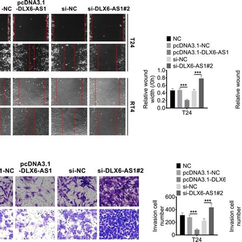 Dlx6 As1 Promotes Migration And Invasion Of Bc Cells A The Migration Download Scientific