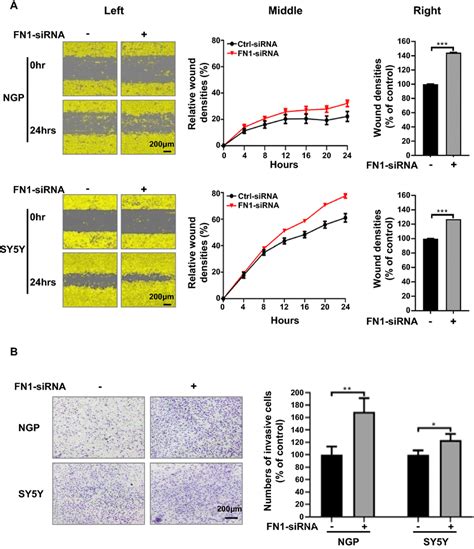 Downregulation Of Fn1 Increased Migration And Invasion Of Nb Cells A