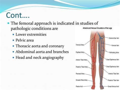 SELDINGER TECHNIQUE & INTERVENTIONAL RADIOLOGY