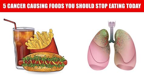 Believe It Or Not This Top 5 Cancer Causing Foods You Should Stop