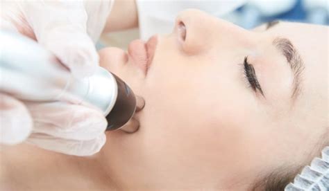 Radiofrequ Ncia Tratamento Flacidez Facial E Corporal Corefisio