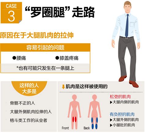 四川省科学健身“微课堂” （11） 「走路 」这项最普遍的运动，你真的走对了吗？ 躯干