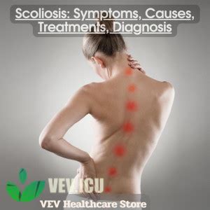 Scoliosis Symptoms Causes Treatments Diagnosis