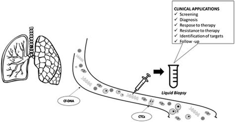 Liquid Biopsy Of Lung Cancer Clinical Applications Cf Dna Circulating