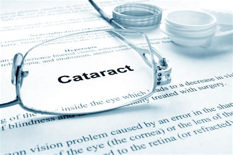 6 Common Cataract Risk Factors Cataract Treatment Paris Tn