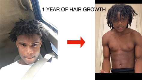 Year Hair Growth Journey Black Men Youtube