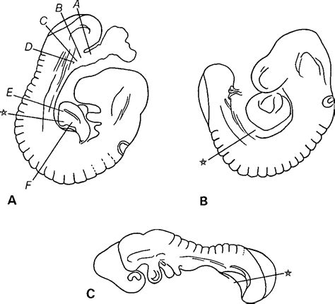 Figure 1 From Development Of Neural Tube Basal Lamina During Neurulation And Neural Crest Cell