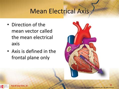 Ppt 12 Lead Ecgs And Electrical Axis Powerpoint Presentation Free Download Id5490745