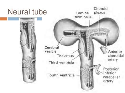 Third Ventricle Surgical Anatomy And Approaches