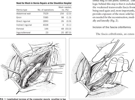 [pdf] The Shouldice Technique A Canon In Hernia Repair Semantic Scholar