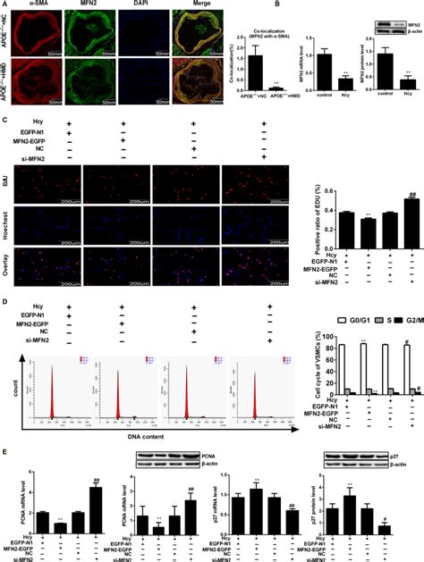 Downregulation Of MFN2 Is Required For The VSMCs Proliferation Induced