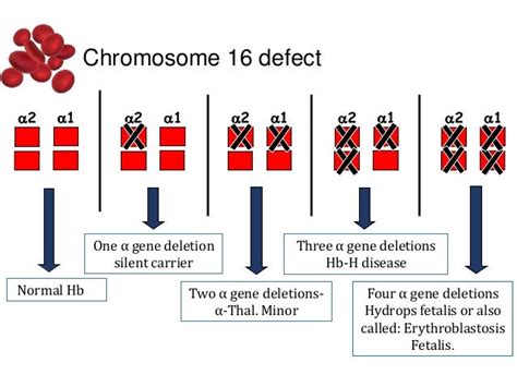 Thalassemia