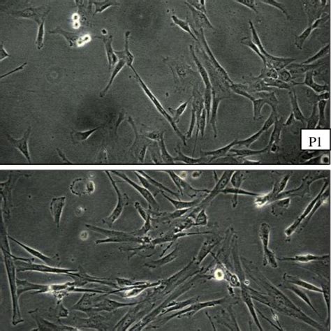 Morphology Of UC Derived Adherent Cells Single Cell Suspension And