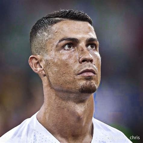 Cristiano Ronaldo Acne