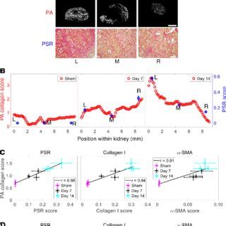 An Overview Of Photoacoustic Pa Imaging With Spectral Unmixing As A