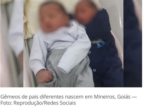 Video Em caso raro jovem engravidou de gêmeos pais diferentes