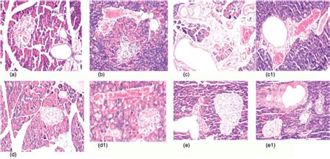 A Photomicrograph Of Pancreas Tissue Section Of Control Rats Showing