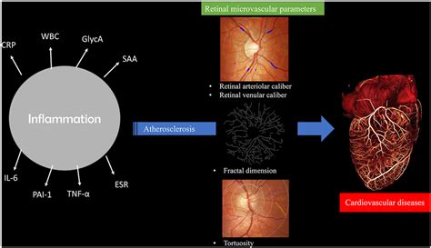 The Association Between Markers Of Inflammation And Retinal