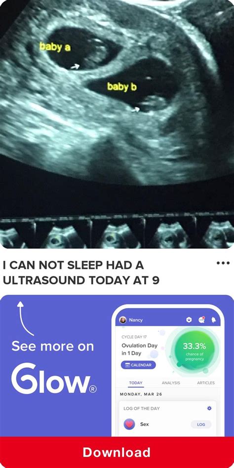 I Can Not Sleep Had A Ultrasound Today At 9 Weeks And Was Told I Was