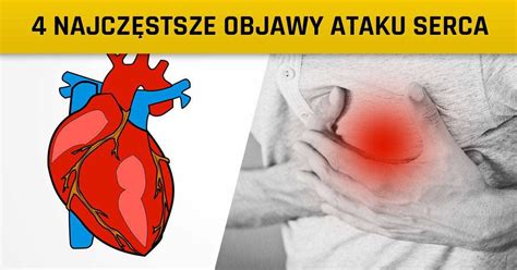 4 NAJCZĘSTSZE OBJAWY ATAKU SERCA Nie możesz ich ignorować